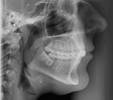 ceph x ray cephalometric